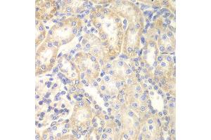 Immunohistochemistry (IHC) image for anti-Deleted in Liver Cancer 1 (DLC1) (AA 204-463) antibody (ABIN3015711) (DLC1 Antikörper  (AA 204-463))