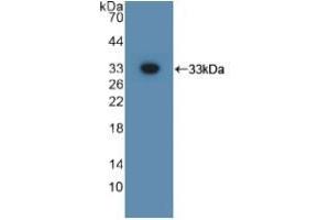 Detection of Recombinant GPC3, Mouse using Polyclonal Antibody to Glypican 3 (GPC3) (Glypican 3 Antikörper  (AA 344-559))