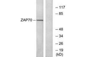 Western blot analysis of extracts from Jurkat cells, using ZAP-70 (Ab-319) Antibody.