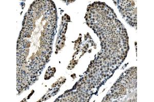 IHC analysis of LSM8 using anti-LSM8 antibody (ABIN7599579). (NAA38 Antikörper  (AA 1-96))