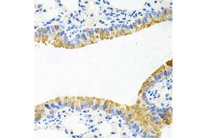 Immunohistochemistry of paraffin-embedded mouse lung using TOB2 antibody at dilution of 1:100 (x40 lens). (TOB2 Antikörper)