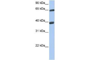 WB Suggested Anti-TKT  Antibody Titration: 0.