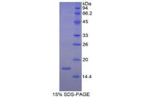 SDS-PAGE (SDS) image for Renalase, FAD-Dependent Amine Oxidase (RNLS) (AA 18-150) protein (His tag) (ABIN1981112)