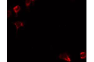 Immunofluorescence (fixed cells) (IF/ICC) image for anti-Arginase, Type II (ARG2) (C-Term) antibody (ABIN6258602)