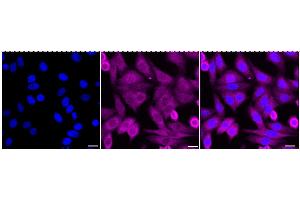 Immunocytochemical staining of HepG2 cells with Peptidylprolyl isomerase D antibody (ABIN7799768), 1:1,000). (Rekombinanter PPID Antikörper)