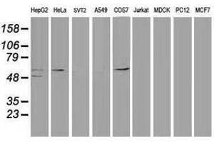 Image no. 3 for anti-Tumor Protein P53 (TP53) antibody (ABIN1499969) (p53 Antikörper)
