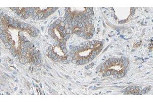 ABIN6276506 at 1/100 staining Human prostate tissue by IHC-P.