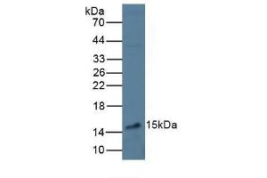 Detection of VEGFA in Mouse Liver Tissue using Polyclonal Antibody to Vascular Endothelial Growth Factor A (VEGFA) (VEGFA Antikörper  (AA 28-147))