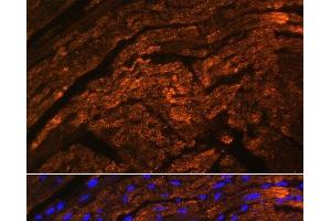 Immunofluorescence analysis of Rat heart using TTN Polyclonal Antibody at dilution of 1:100. (Titin Antikörper)