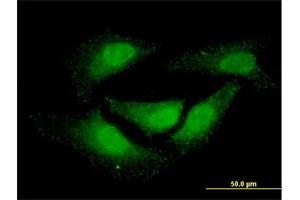 Immunofluorescence of monoclonal antibody to NR0B1 on HeLa cell. (NR0B1 Antikörper  (AA 361-470))