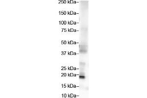 WB Suggested Anti-FGF2 Antibody Titration:  2 ug/ml  ELISA Titer:  1:312500  Positive Control:  Hela cell lysate (FGF2 Antikörper  (Middle Region))