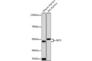 Western blot analysis of extracts of various cell lines, using SKP2 Rabbit mAb (ABIN1680764, ABIN3018459, ABIN3018460 and ABIN7101615) at 1:1000 dilution.