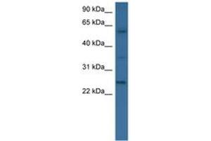 Image no. 1 for anti-Bone Morphogenetic Protein 6 (BMP6) (AA 46-95) antibody (ABIN6746538) (BMP6 Antikörper  (AA 46-95))