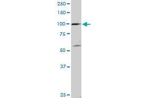 SCYL2 MaxPab rabbit polyclonal antibody. (SCYL2 Antikörper  (AA 1-929))