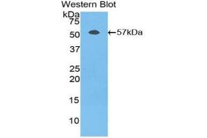 Western blot analysis of the recombinant protein. (Fibrinogen beta Chain Antikörper  (AA 49-495))
