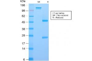 SDS-PAGE Analysis Purified NGFR Mouse Recombinant Monoclonal Antibody (rNGFR/1965).