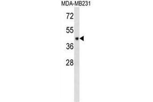 Western blot analysis in MDA-MB231 cell line lysates using CF150 Antibody (Center) Cat. (C6orf150 Antikörper  (Middle Region))