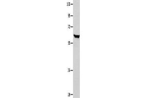 Western Blotting (WB) image for anti-DnaJ (Hsp40) Homolog, Subfamily C, Member 7 (DNAJC7) antibody (ABIN2421969) (DNAJC7 Antikörper)
