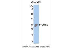 Western Blotting (WB) image for anti-Retinol Binding Protein 4, Plasma (RBP4) (AA 63-245) antibody (ABIN1078483) (RBP4 Antikörper  (AA 63-245))