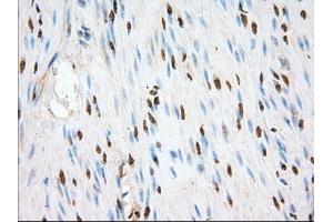 Image no. 10 for anti-Transforming, Acidic Coiled-Coil Containing Protein 3 (TACC3) antibody (ABIN1498099) (TACC3 Antikörper)