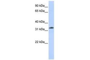 Image no. 1 for anti-Siah E3 Ubiquitin Protein Ligase 2 (SIAH2) (N-Term) antibody (ABIN6744237) (SIAH2 Antikörper  (N-Term))