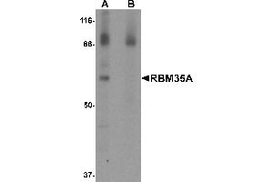 Western Blotting (WB) image for anti-Epithelial Splicing Regulatory Protein 1 (ESRP1) (N-Term) antibody (ABIN1031534) (ESRP1 Antikörper  (N-Term))