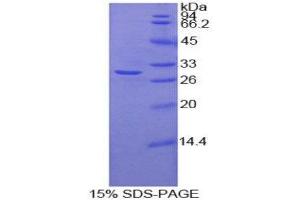 SDS-PAGE (SDS) image for Fucosyltransferase 4 (Alpha (1,3) Fucosyltransferase, Myeloid-Specific) (FUT4) (AA 264-497) protein (His tag,T7 tag) (ABIN1879428)