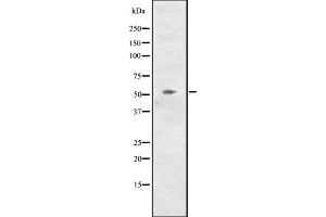 Western blot analysis of CCNL2 expression in NCI-H460 cell line lysates ,The lane on the left is treated with the antigen-specific peptide. (Cyclin L2 Antikörper  (C-Term))