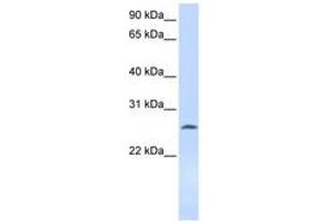 Image no. 1 for anti-Deoxycytidine Kinase (DCK) (AA 108-157) antibody (ABIN6743592) (DCK Antikörper  (AA 108-157))