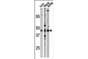 Image no. 2 for anti-E2F Transcription Factor 1 (E2F1) (pSer337) antibody (ABIN358119) (E2F1 Antikörper  (pSer337))