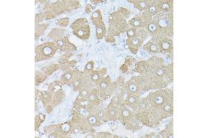 Immunohistochemistry (IHC) image for anti-Glutamate-Ammonia Ligase (GLUL) (AA 1-373) antibody (ABIN6141161)