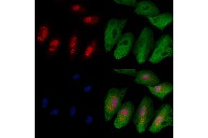 ABIN6263540 and ABIN6279810 staining  cells by IF/ICC. (NCKIPSD Antikörper  (Internal Region))