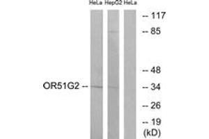 Western blot analysis of extracts from HeLa/HepG2 cells, using OR51G2 Antibody. (OR51G2 Antikörper  (AA 211-260))