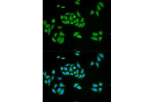 Immunofluorescence analysis of HeLa cell using UPF1 antibody.