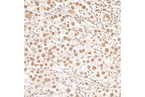 Immunohistochemistry (IHC) image for anti-Structural Maintenance of Chromosomes 1A (SMC1A) (pSer966) antibody (ABIN7455211)