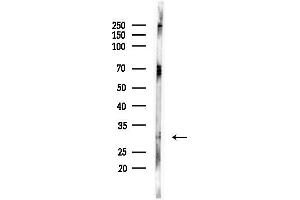 anti-Cyclin D3 (CCND3) (pThr283) antibody