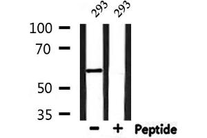 Western blot analysis of extracts from 293, using YTHDF1 Antibody. (YTHDF1 Antikörper  (N-Term))