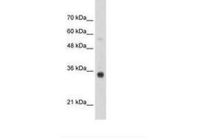 Image no. 1 for anti-Homeobox B4 (HOXB4) (N-Term) antibody (ABIN203345) (HOXB4 Antikörper  (N-Term))