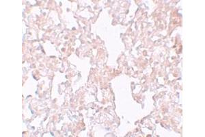 Immunohistochemistry (IHC) image for anti-Major Facilitator Superfamily Domain Containing 1 (MFSD1) (Middle Region) antibody (ABIN1031003) (MFSD1 Antikörper  (Middle Region))