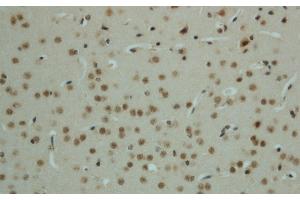 Immunohistochemistry of paraffin-embedded mouse brain using Phospho-AMPK alpha1/2 (Thr183/172) Polyclonal Antibody at dilution of 1:50 (PRKAA1/PRKAA2 Antikörper  (pThr172, pThr183))