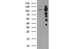 HEK293T cells were transfected with the pCMV6-ENTRY control (Left lane) or pCMV6-ENTRY TACC3 (Right lane) cDNA for 48 hrs and lysed. (TACC3 Antikörper)