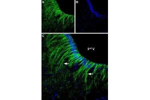 Expression of α2A-Adrenoreceptor in rat hypothalamusImmunohistochemical staining of rat ventromedial hypothalamus free floating frozen section using Anti-α2A-Adrenergic Receptor (extracellular) Antibody (ABIN7042899, ABIN7043918 and ABIN7043919), (1:250). (Alpha-2A Adrenergic Receptor (ADRA2A) Peptid)