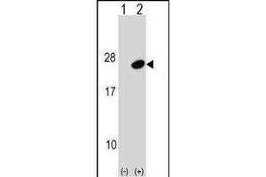 Western blot analysis of UBE2G1 (arrow) using rabbit polyclonal UBE2G1 Antibody (C-term) (ABIN1536693 and ABIN2848805). (UBE2G1 Antikörper  (C-Term))