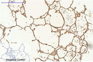 Immunohistochemical analysis of paraffin-embedded human lung tissue. (Caspase 9 Antikörper)