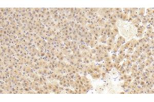 Detection of FIGN in Human Liver Tissue using Polyclonal Antibody to Fidgetin (FIGN) (Fidgetin Antikörper  (AA 1-308))