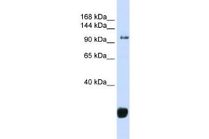 WB Suggested Anti-FBXO10 Antibody Titration: 0. (FBXO10 Antikörper  (Middle Region))
