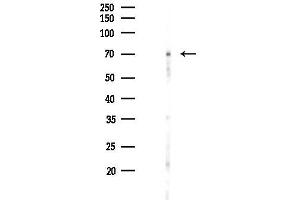 Western blot analysis of lysates from Mouse lung, using Phospho-SLP76 (Tyr128) Antibody at 1/1000 dilution.