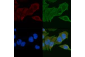 ABIN6257883 and ABIN6275262 staining Hela cells by IF/ICC. (MYOM2 Antikörper  (Internal Region))