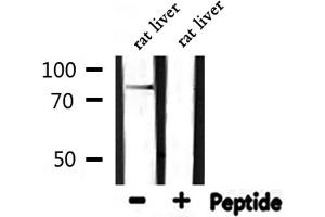 Western blot analysis of extracts from rat liver, using CDH18 Antibody. (CDH18 Antikörper  (N-Term))