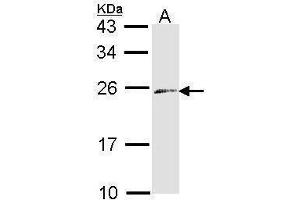 WB Image Sample (30 ug of whole cell lysate) A: Raji 12% SDS PAGE antibody diluted at 1:1000 (Endothelin 3 Antikörper)